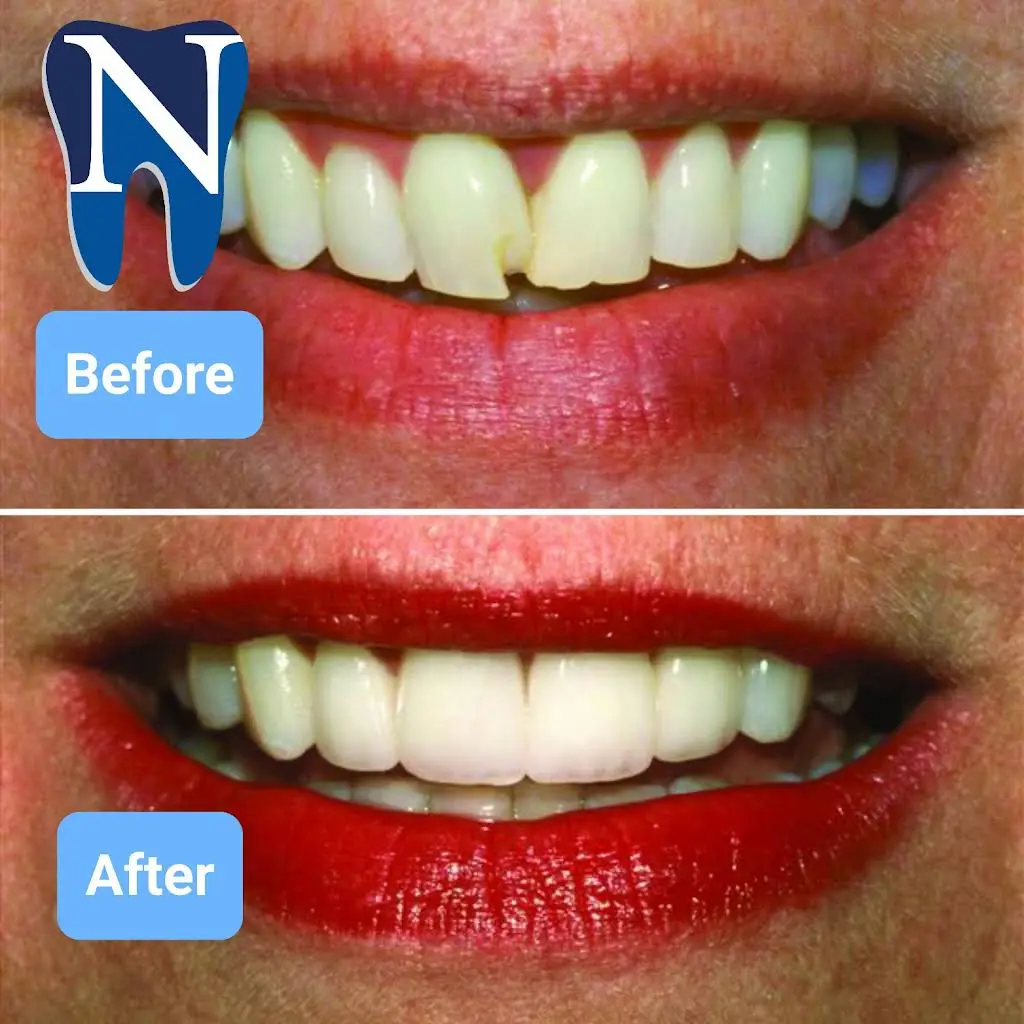Norton Family Dental