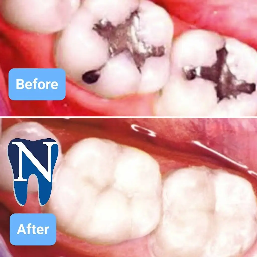 Norton Family Dental