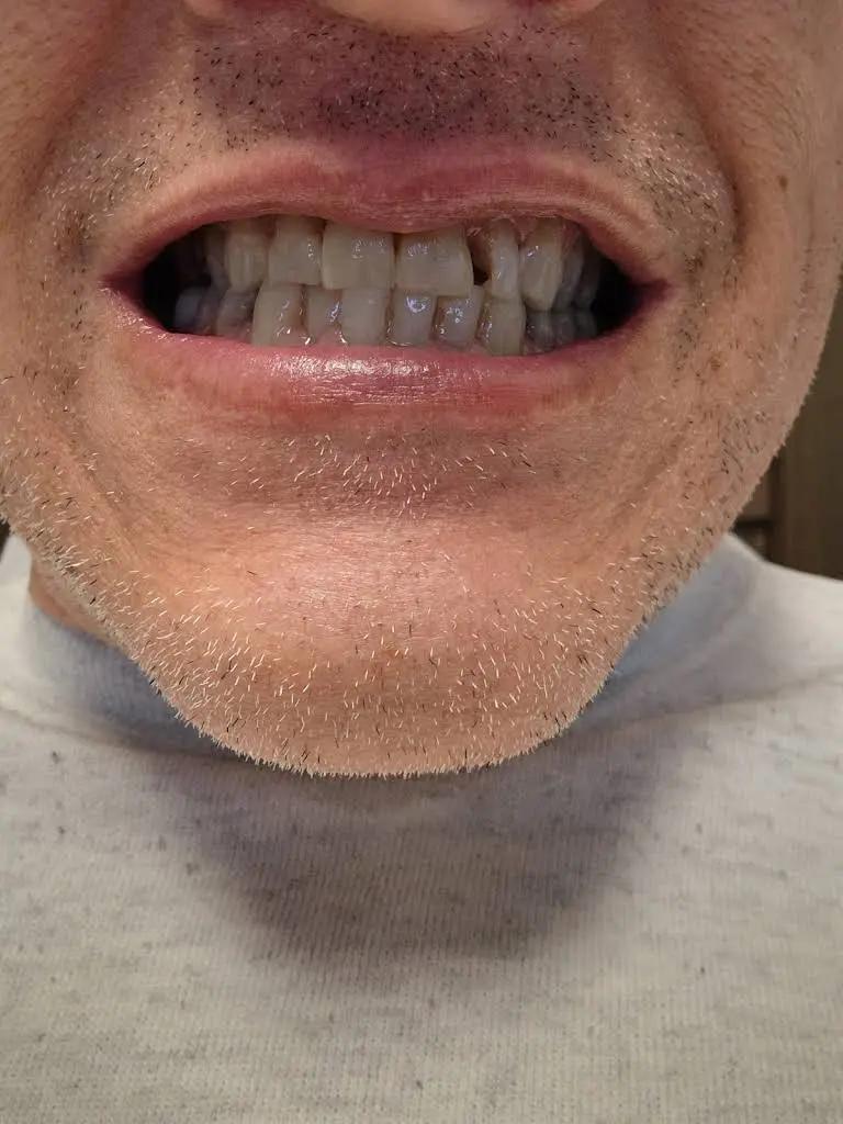 Smith Crossing Dental Care