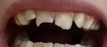 Adam J Frieder DDS