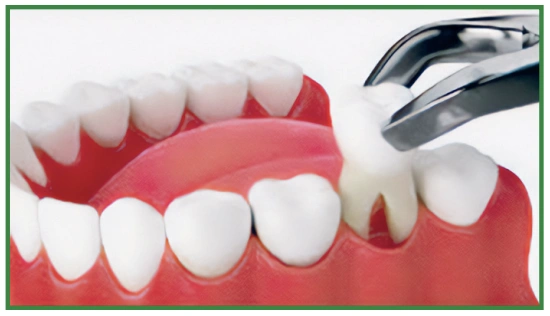 Hillview Dentures and Implants