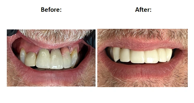 Denver Dental Care