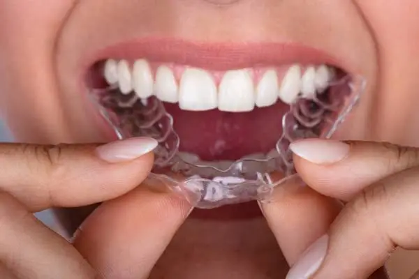 Parkway Dentistry at Langtree