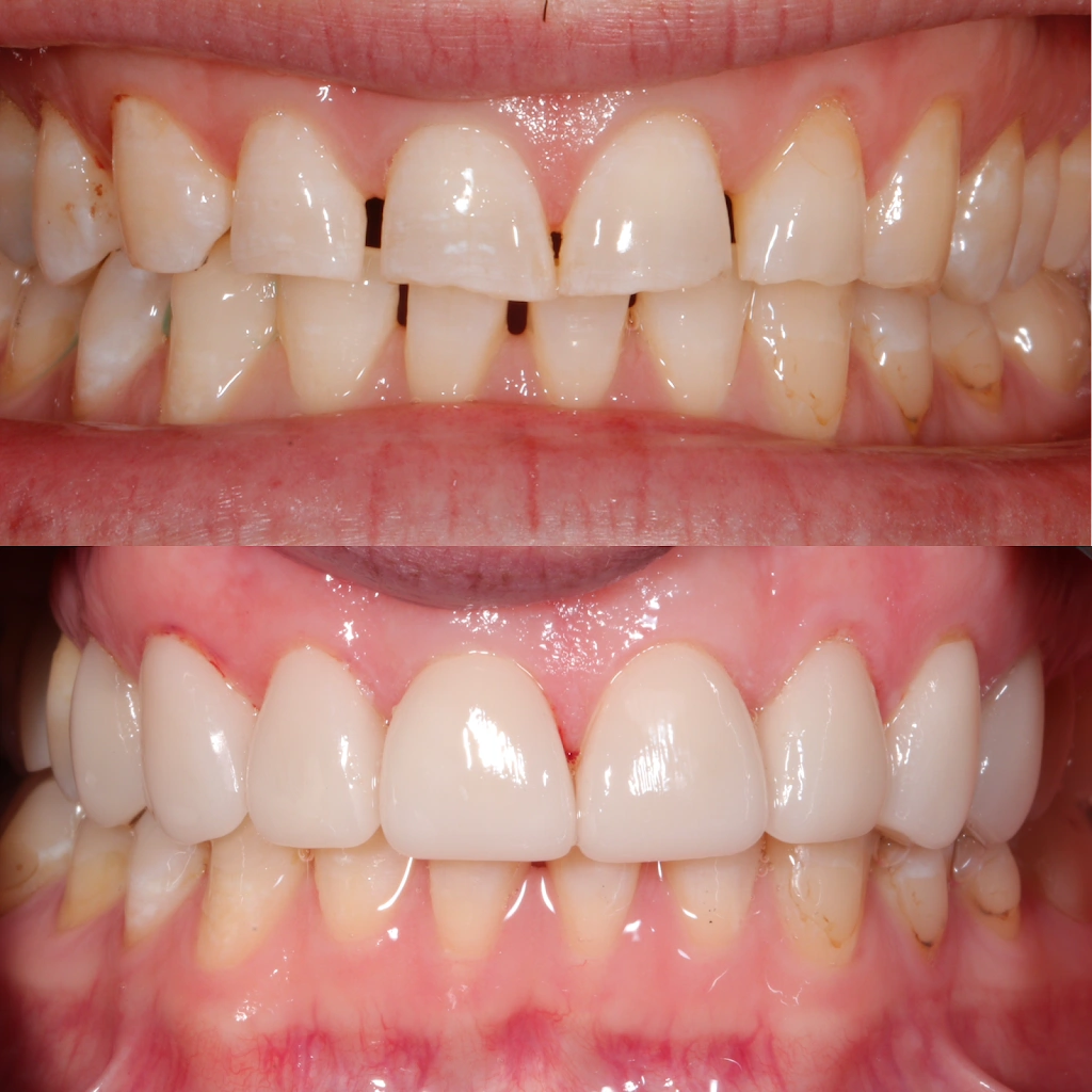 Contour Dentistry