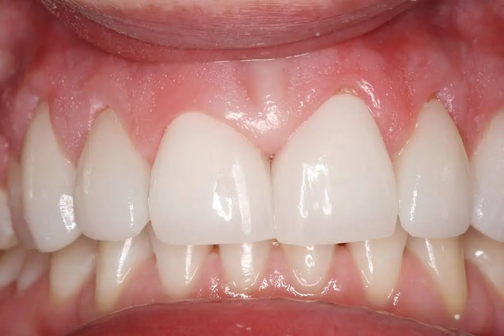 Joel A. Gentry, DDS, PLLC
