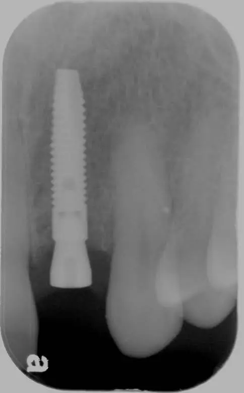 Joel A. Gentry, DDS, PLLC