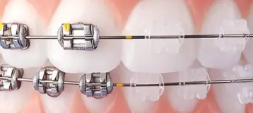 PearlFection Dentistry