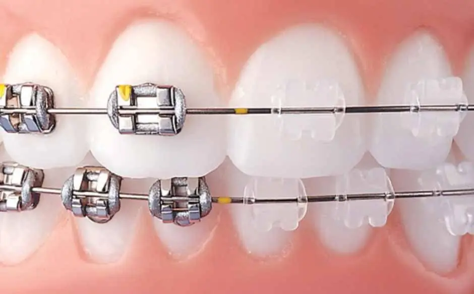 PearlFection Dentistry