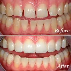 Valley Dental Associates