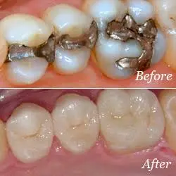 Valley Dental Associates