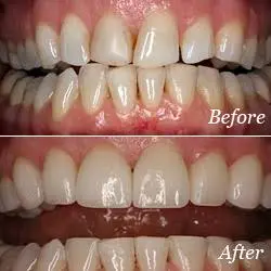 Valley Dental Associates