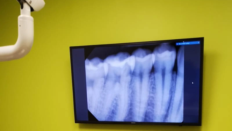 Fresh Dental Huntersville NC