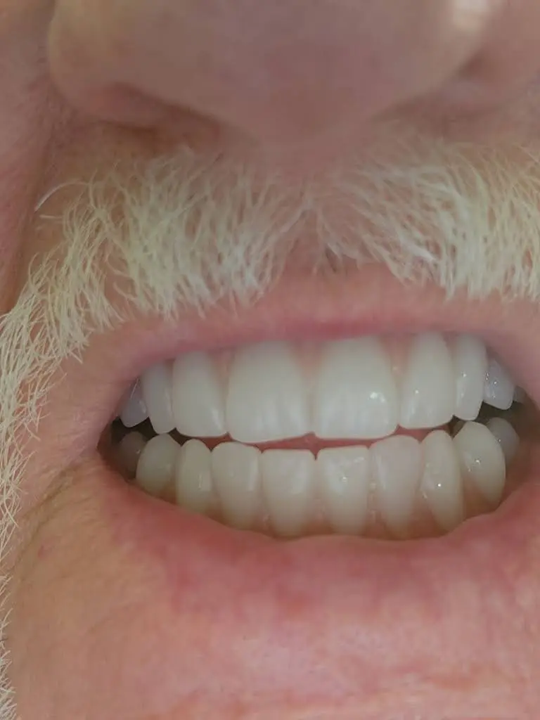 Aspen Dental