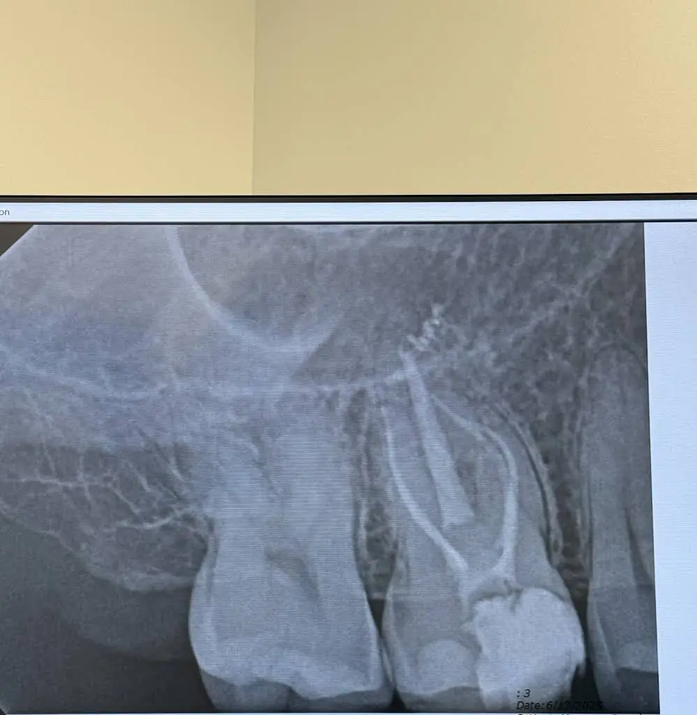 Belmont Endodontics