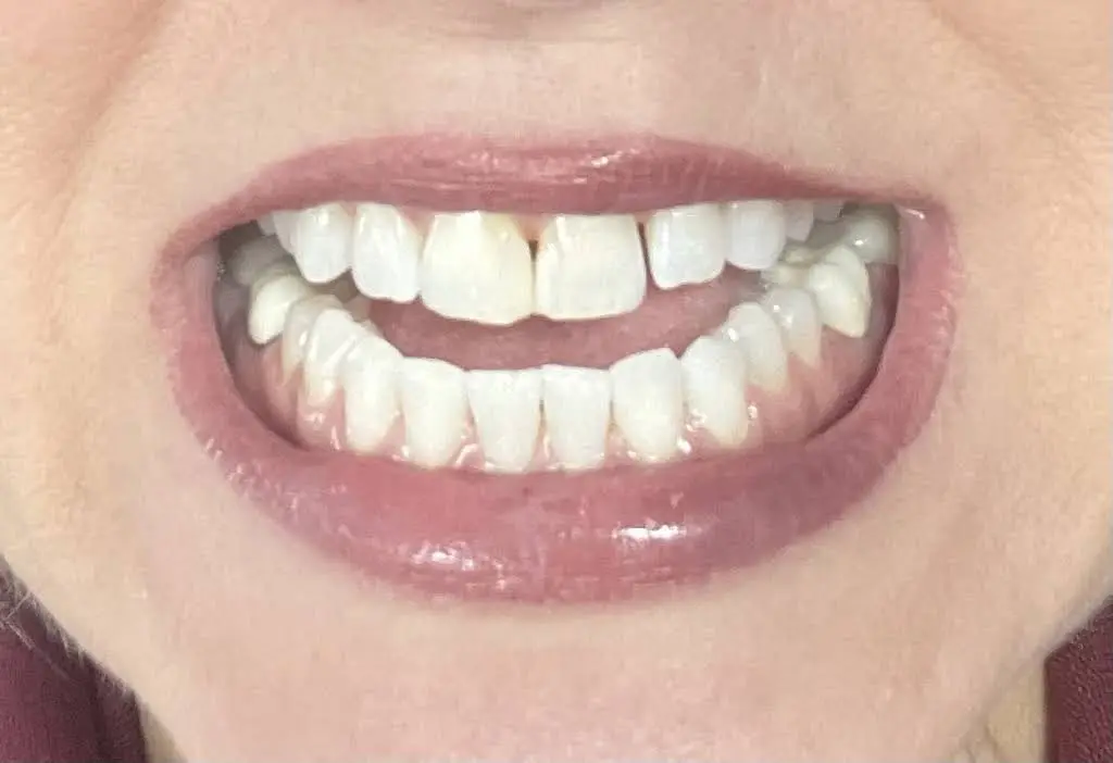 Parkway Dentistry At Landis