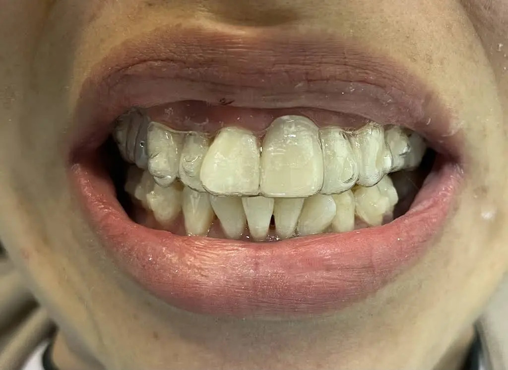 University Dental Associates High Point