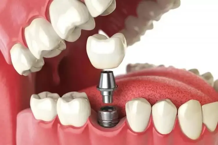 University Dental Associates