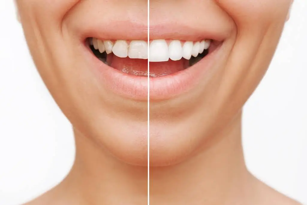 Hartzell General Dentistry