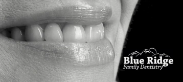 Blue Ridge Family Dentistry