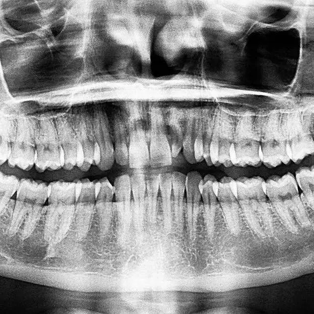 Blue Ridge Family Dentistry