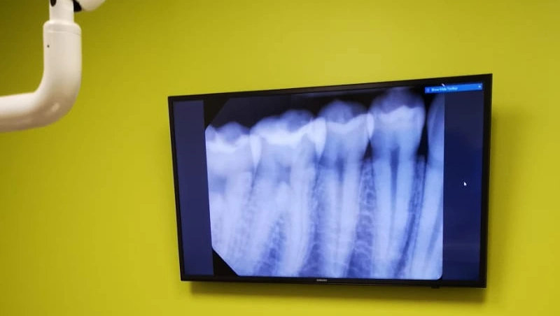 Fresh Dental Gastonia NC