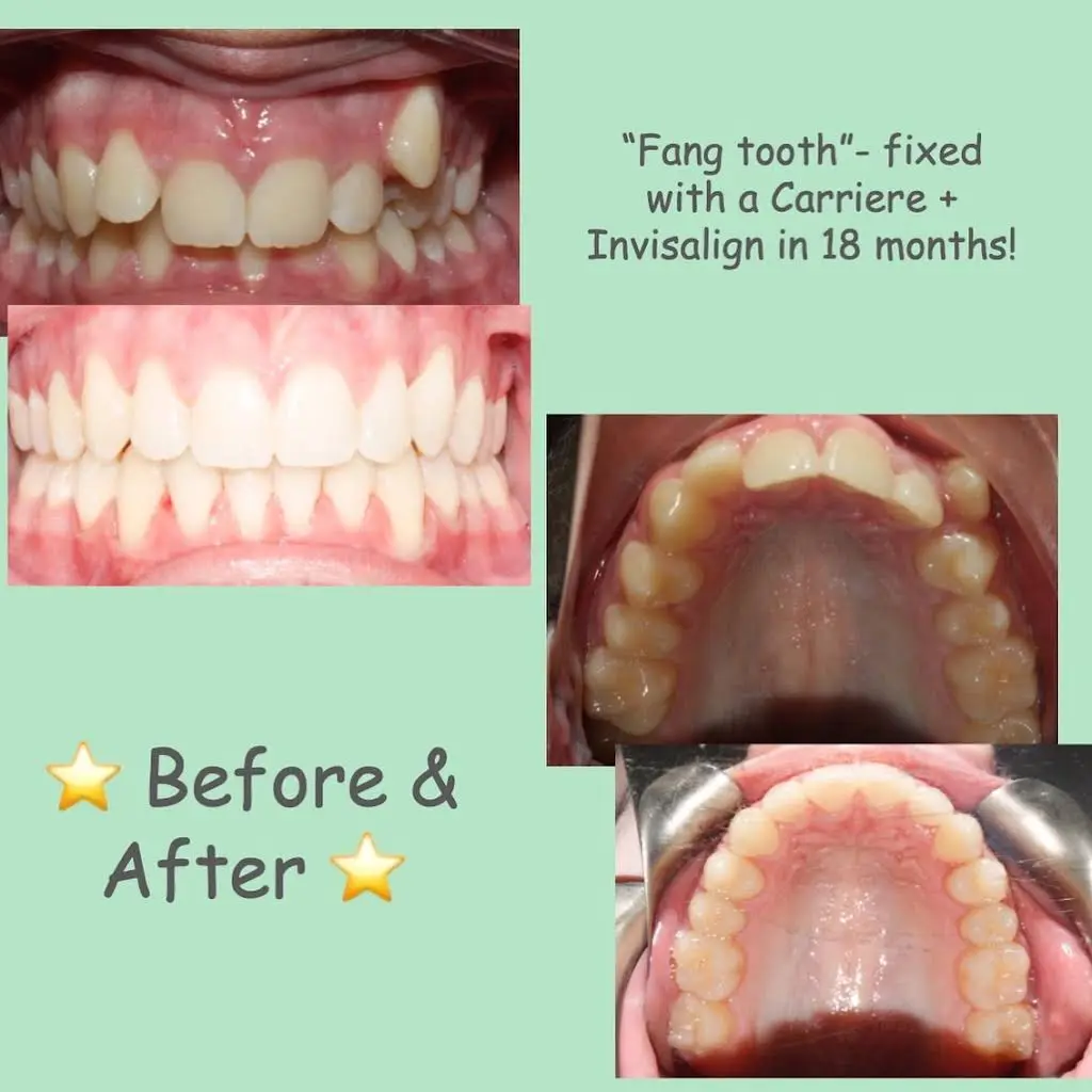 Best Orthodontics