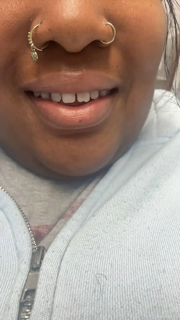 HPU Health - Madison Woods Dental