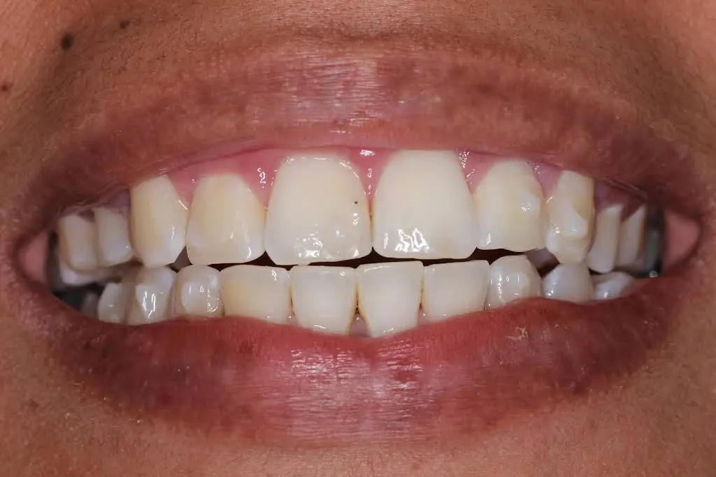 Ideal Smile Dentistry