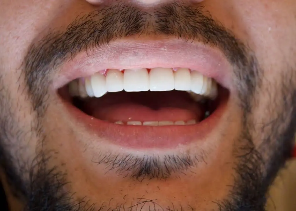 Ideal Smile Dentistry