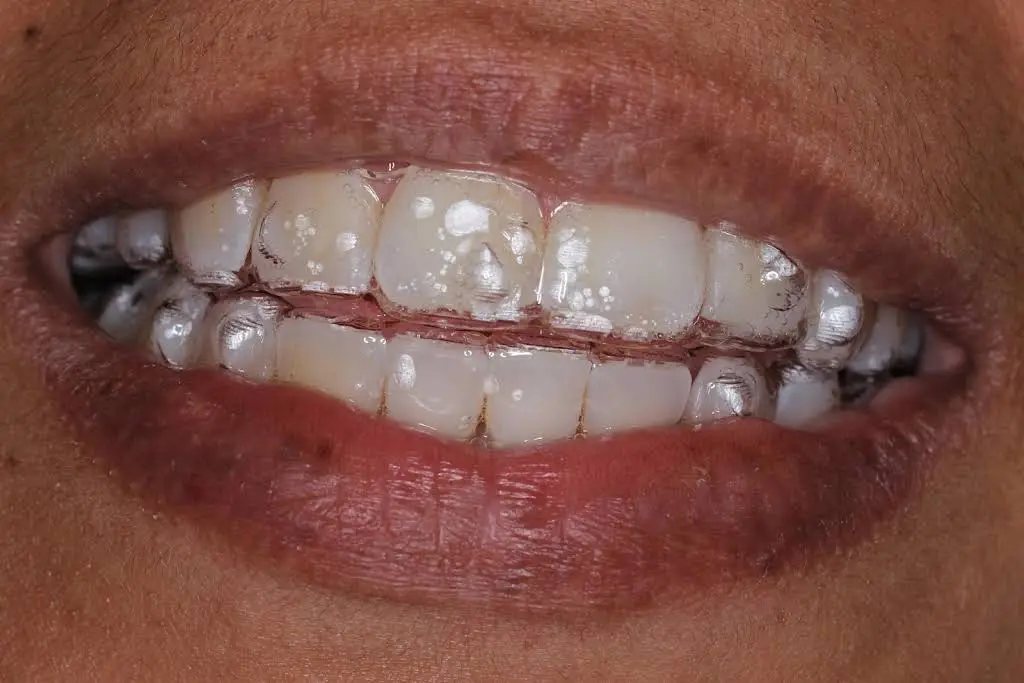 Ideal Smile Dentistry