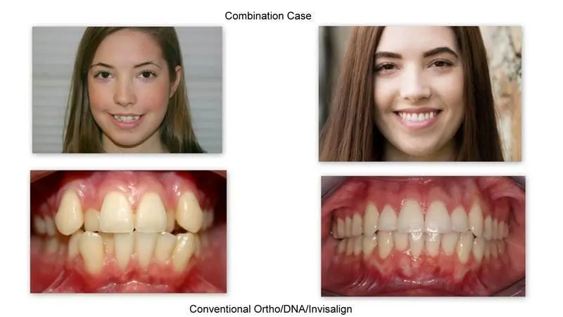 Appalachian Dental