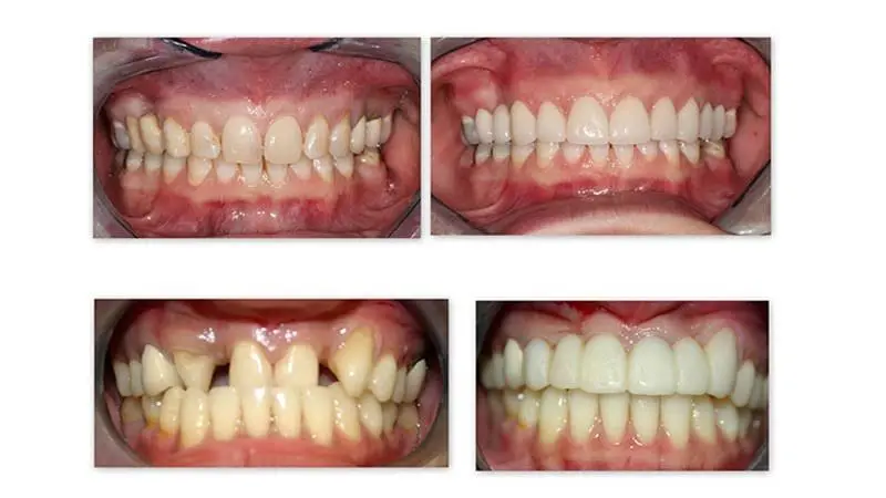 Appalachian Dental