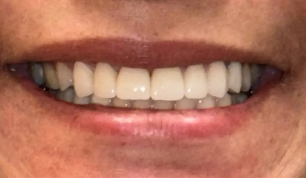University Dental Associates Benfield