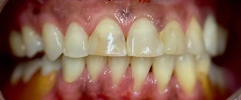 University Dental Associates Benfield