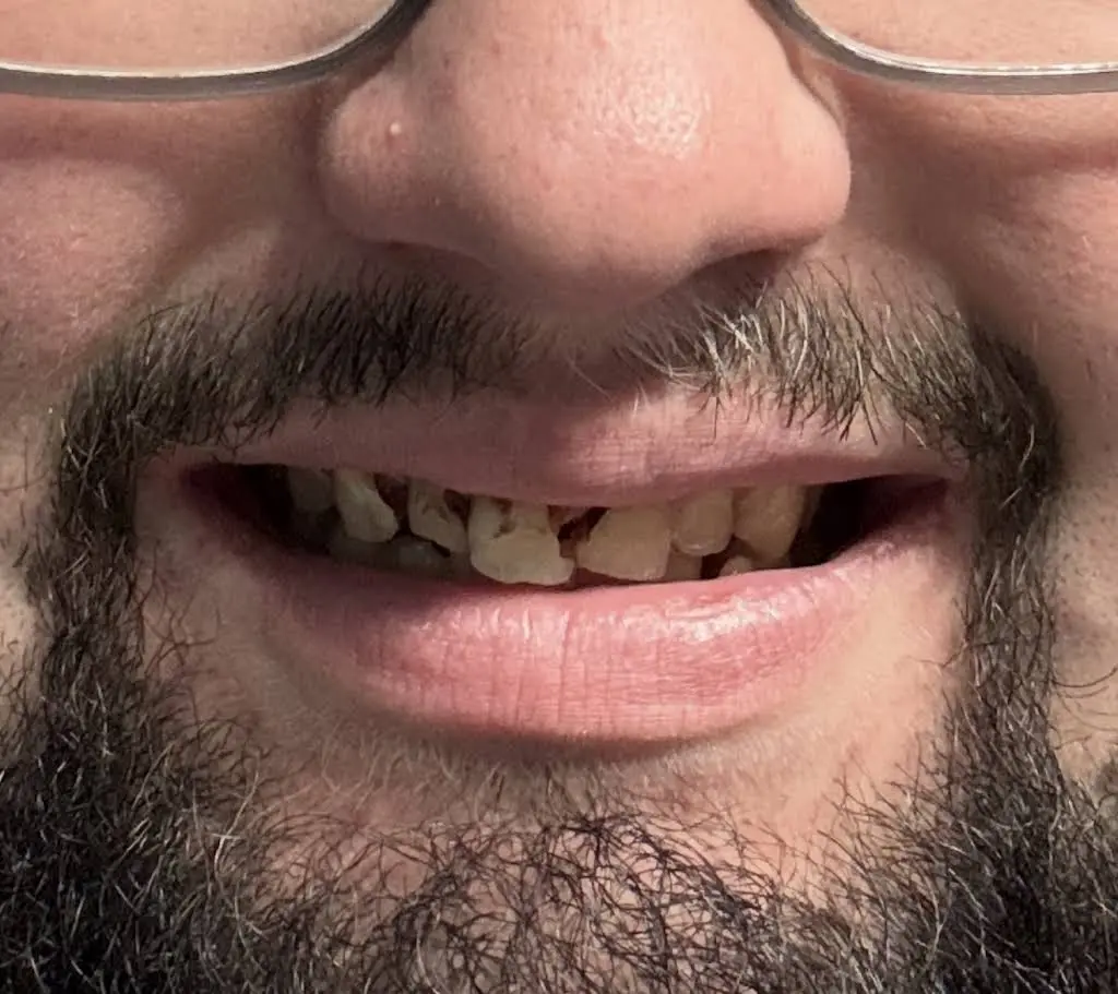 University Dental Associates Benfield