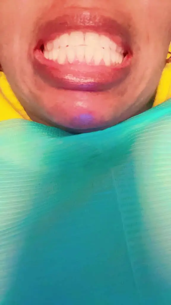 Dental Care at Gaston Day