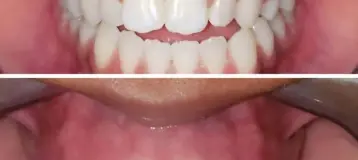 Cosmetic Dentistry of the Carolinas