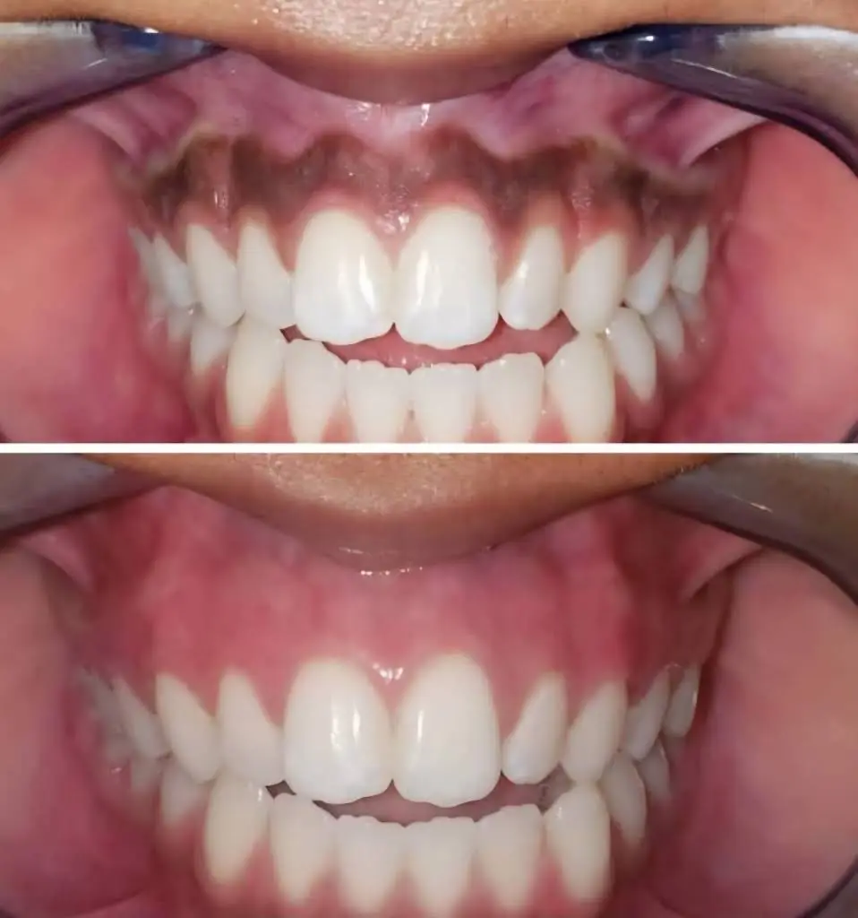 Cosmetic Dentistry of the Carolinas