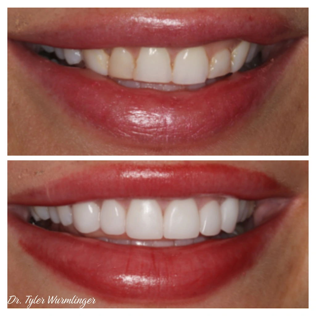 Cosmetic Dentistry of the Carolinas