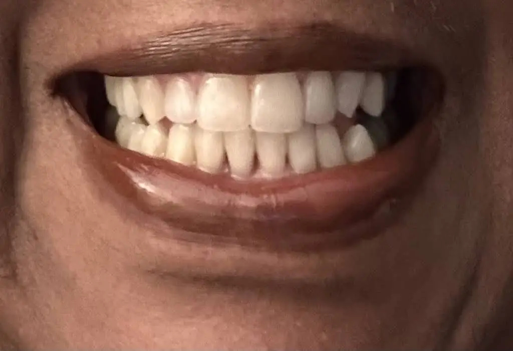 Eagle Shembo Dentistry - Charlotte