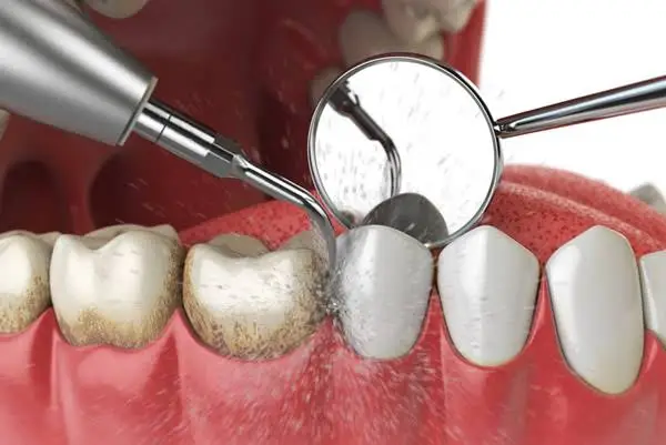 Myers Park Dental Partners