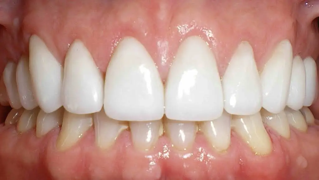 Mango Dental