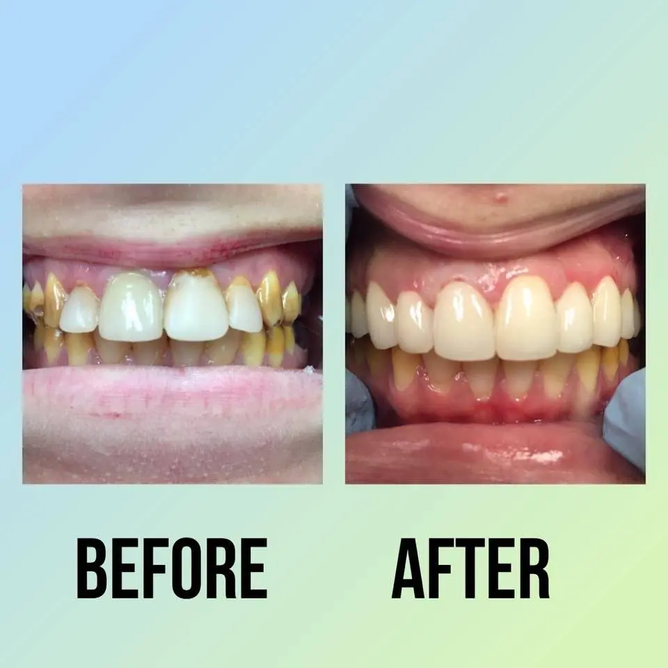 Progressive Dental of Mechanicsville