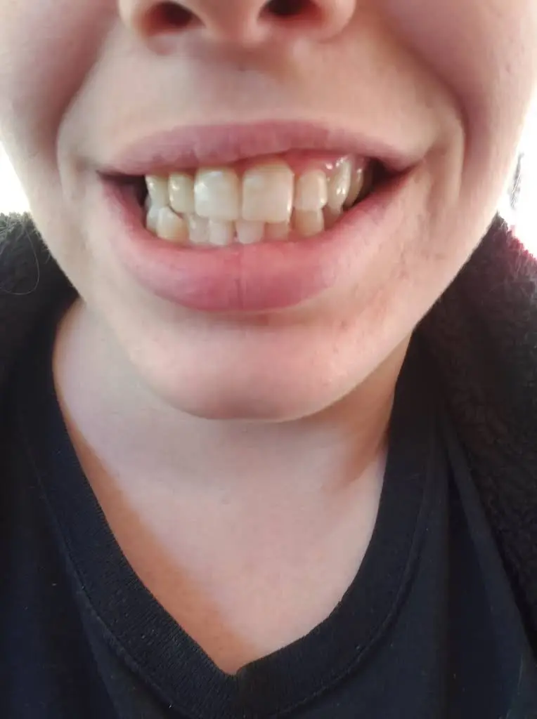 Strauss Dentistry