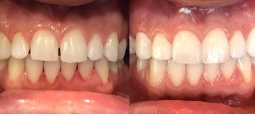 Lineberger Dentistry