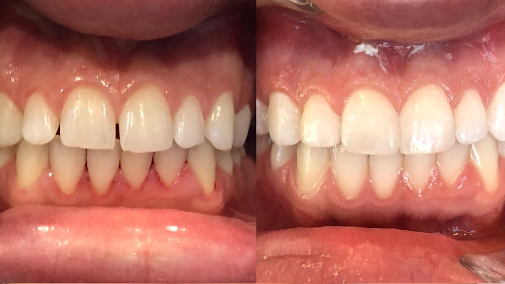 Lineberger Dentistry