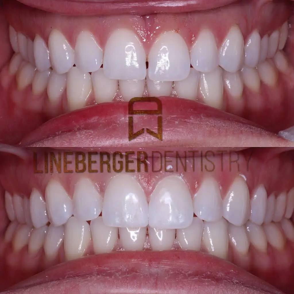 Lineberger Dentistry