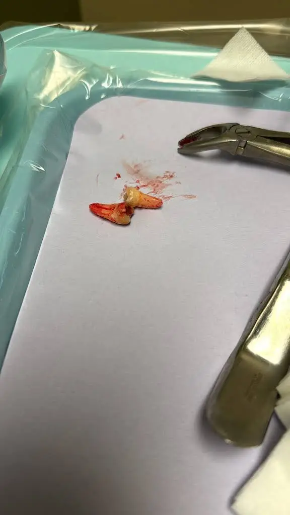 Affordable Dentures & Implants