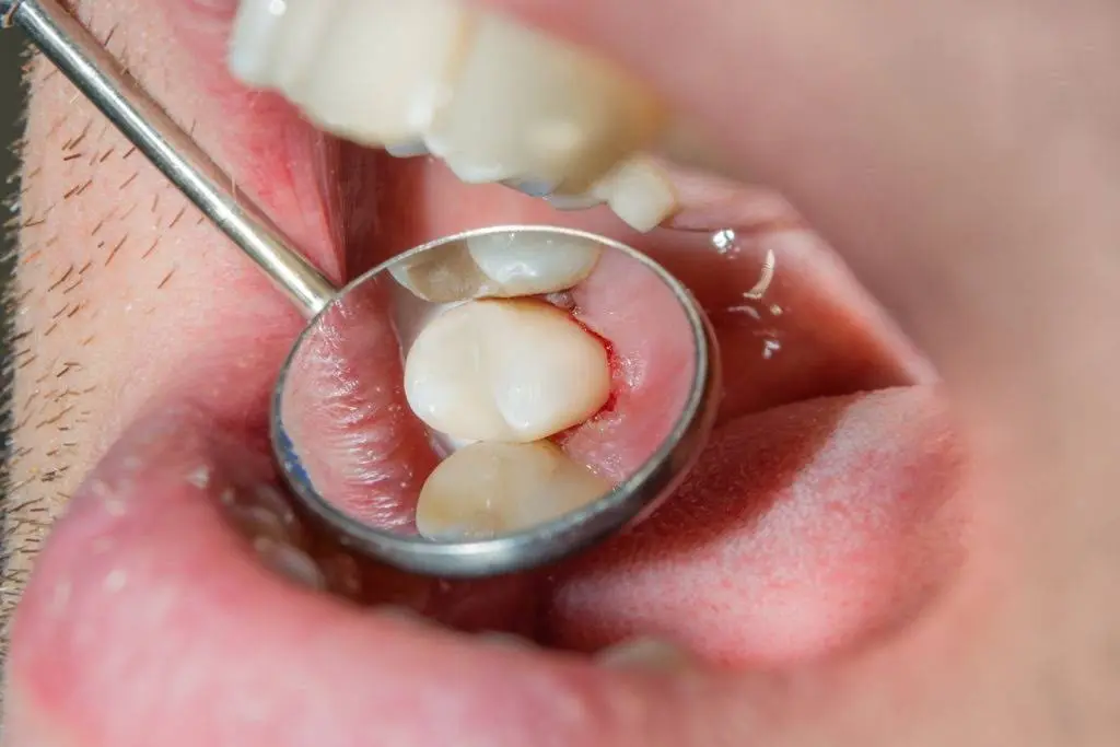 Charlotte Emergency Dental