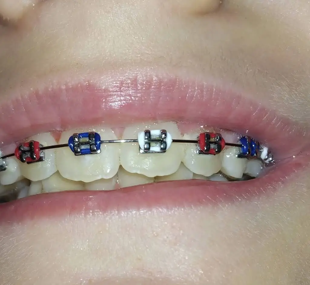 McMillian Orthodontics